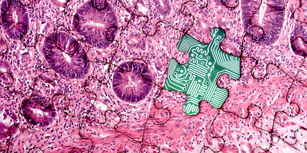 A graphic showing a microscopic view of cells, divided into jigsaw pieces. One of the pieces is missing, revealing part of an electronic microchip.