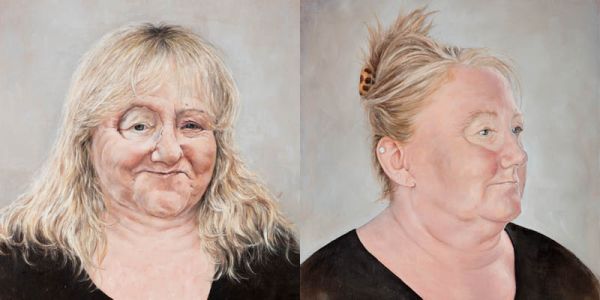 Two oil paintings of a person's face, one in profile. The person has a prosthetic around the eye.