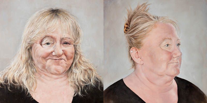 Two oil paintings of a person's face, one in profile. The person has a prosthetic around the eye.