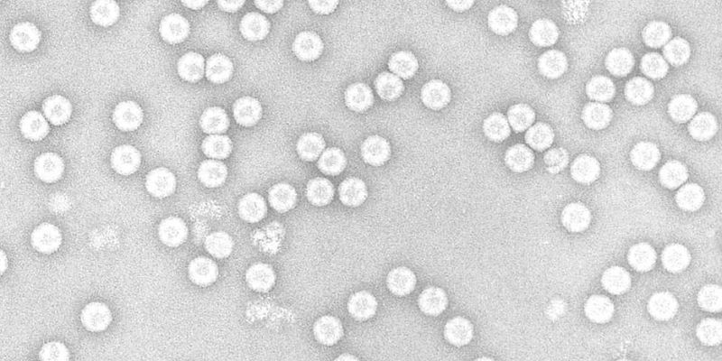 A microscopic view of poliovirus, which looks like clusters of white dots on a grey background